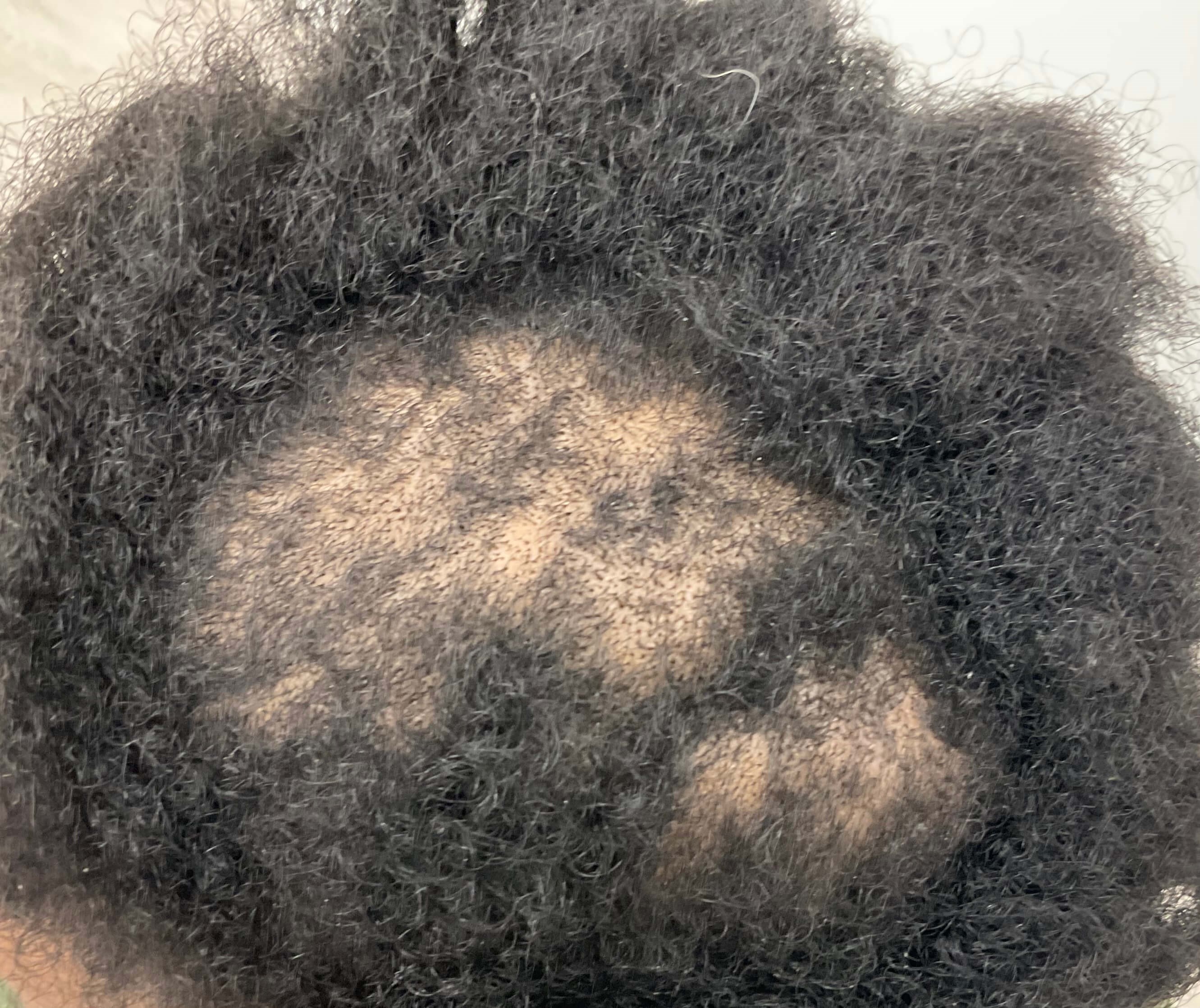 Before Image