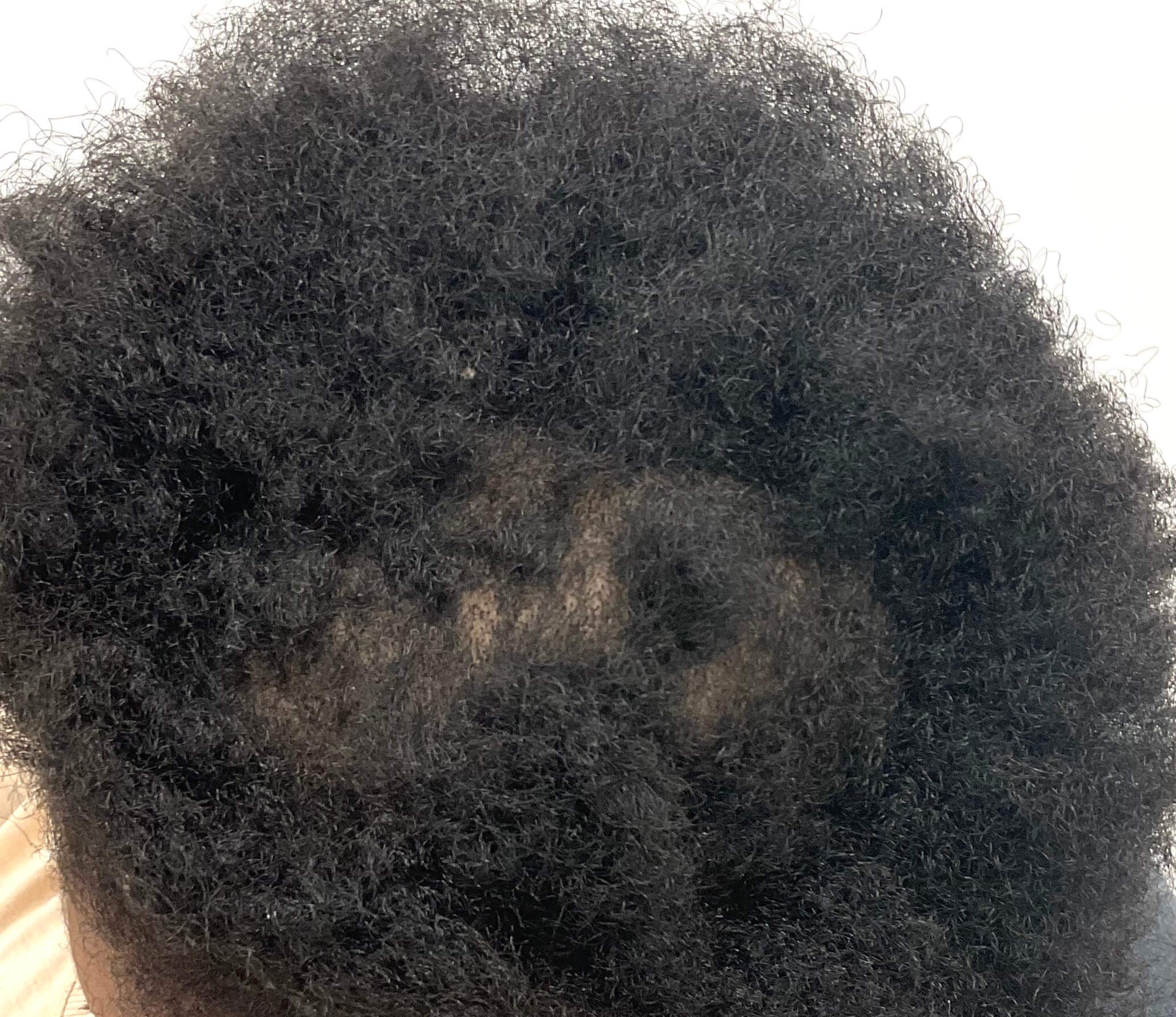 After Image