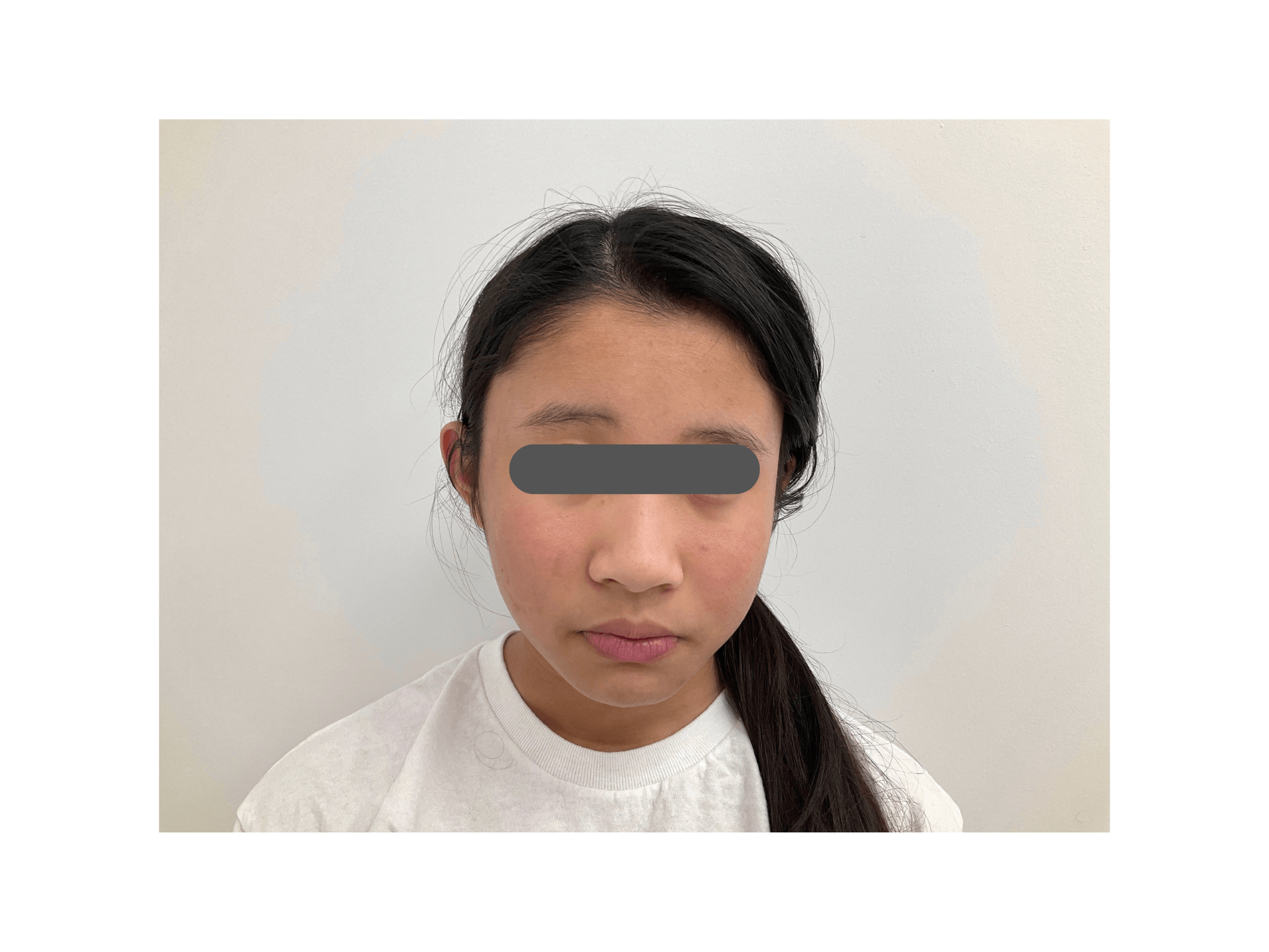 After Image