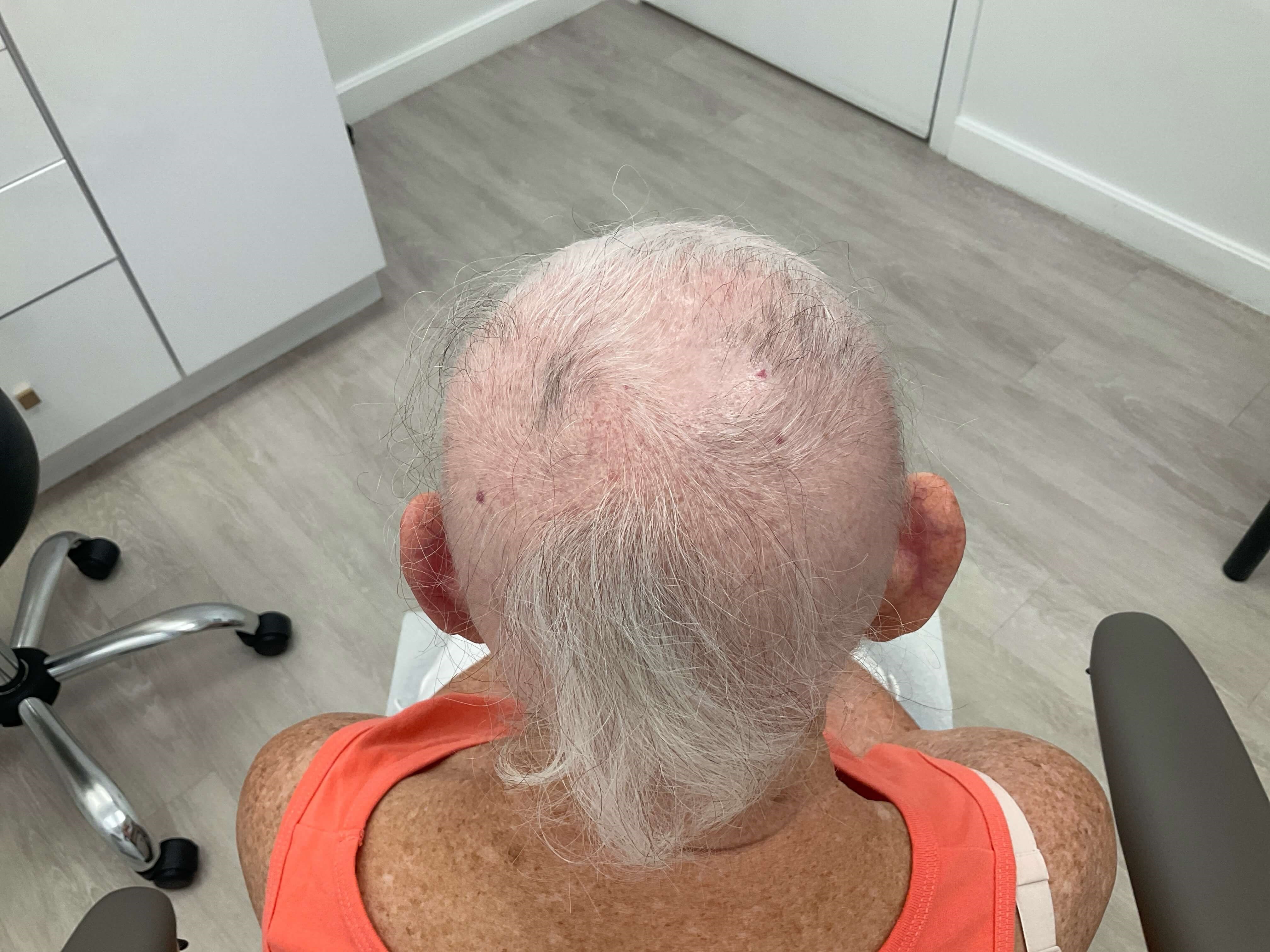 Before Image