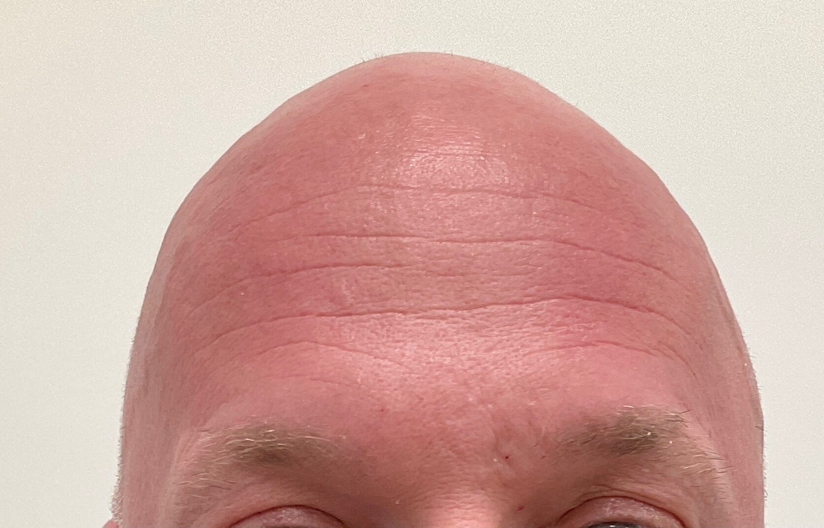Before Image