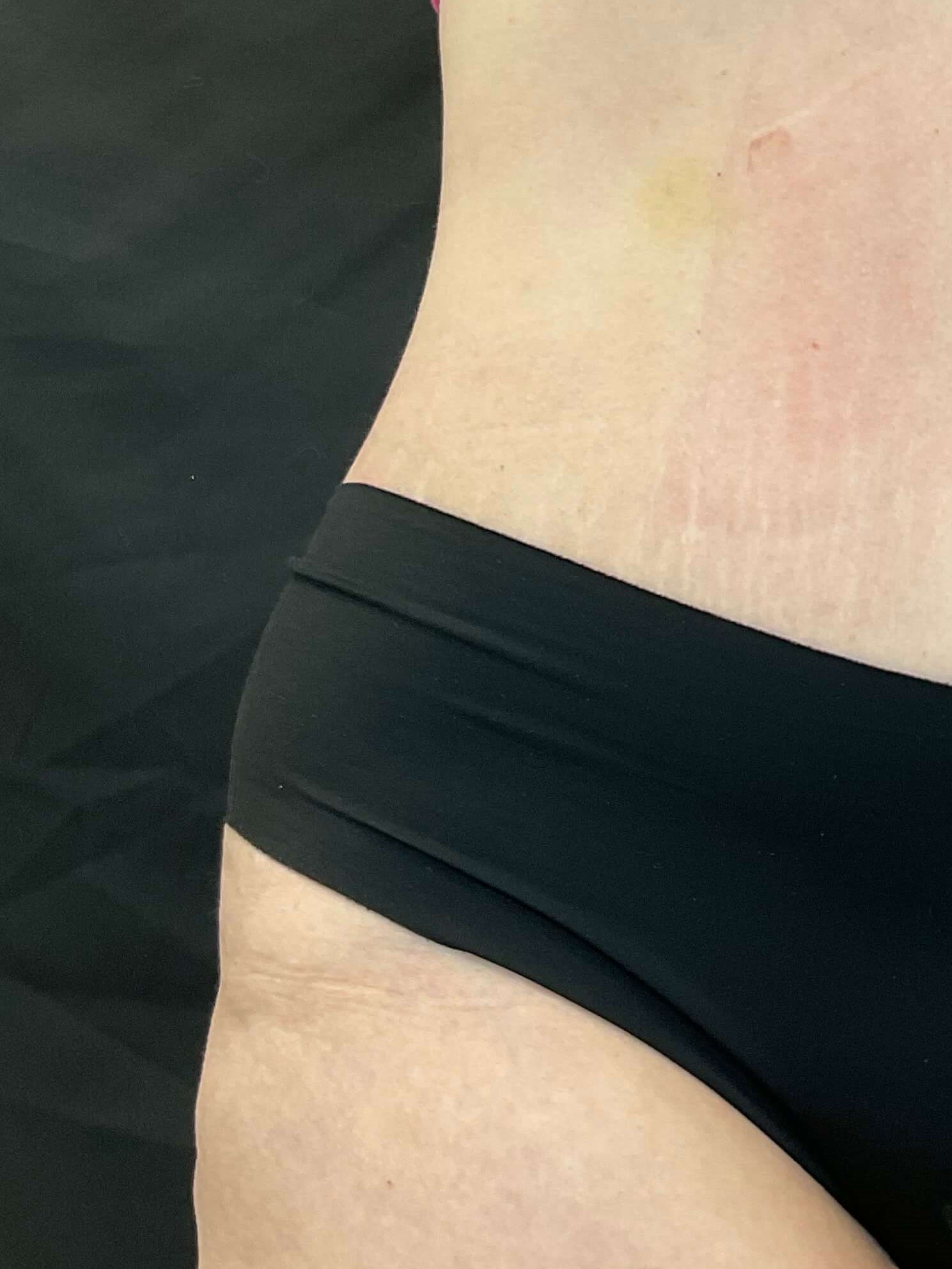 Body sculpt with EvolveX After