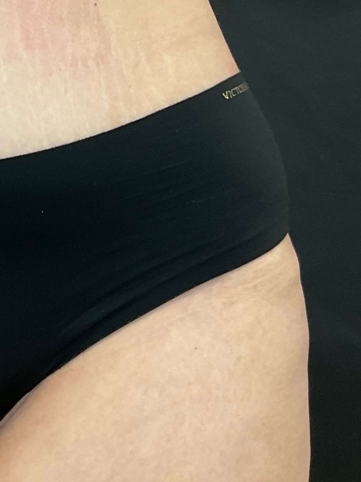 Body sculpt with EvolveX After